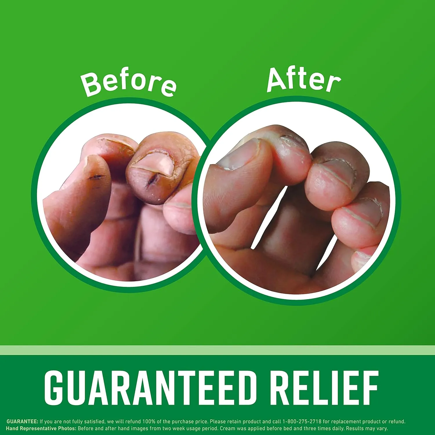 O'Keeffe's Working Hands Hand Cream for Extreme Dryness - 3.4 oz Jar (2 Pack) - Repairing Skincare for Cracked, Dry Hands